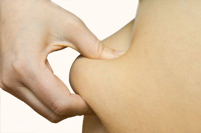 Supprimer durablement les poignés d'amour avec la cryolipolyse à Paris