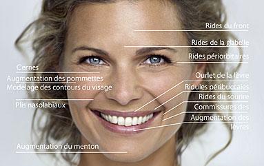 Rajeunissement du visage grace à des injection d'acide hyaluronique à Paris