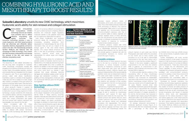 Article sur la mésothérapie associé aux injections d'acide hyaluronique